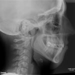 x-ray